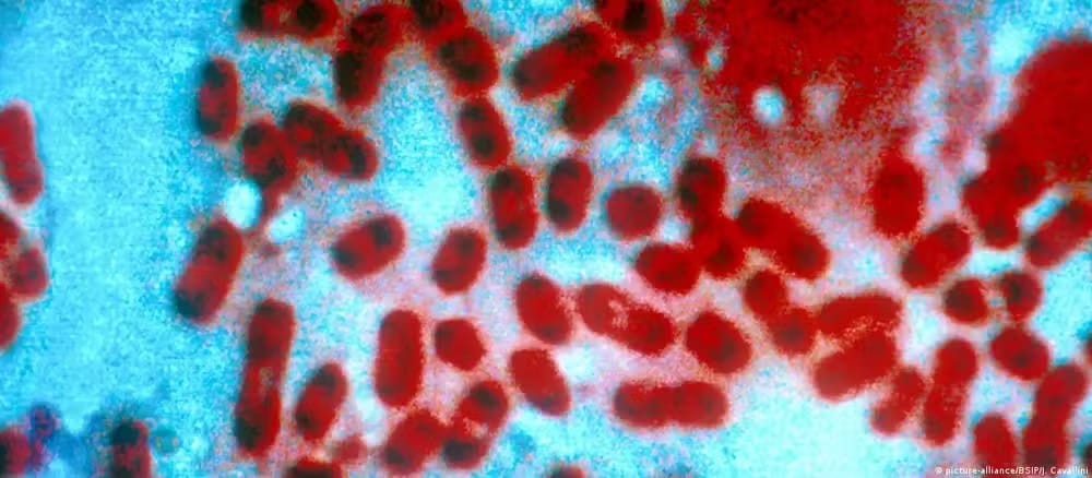 Morte de pesquisadora em laboratório antipeste acende alerta na Rússia